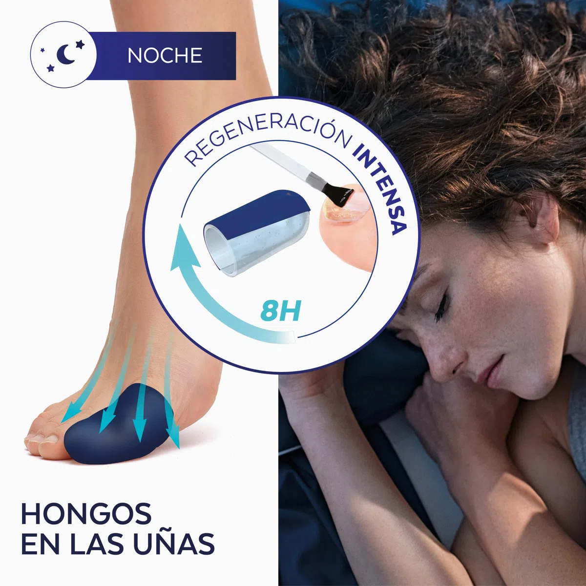 PODERM – HONGOS UÑAS PIES TRATAMIENTO PROFESIONAL DE NOCHE INTENSIVO 2 en 1 – Elimina la micosis | VEGANO | pies/manos | Fácil y rápido | Swiss Made