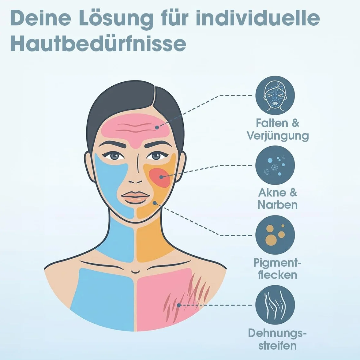 P-Beauty Dermapen M1 Cartuchos de aguja para microneedling – Cartuchos de aguja de repuesto para coche Derma Elektrik Pen M1 – Cierre de rosca WWWELLE – contra arrugas, acné y cicatrices (20 unidades