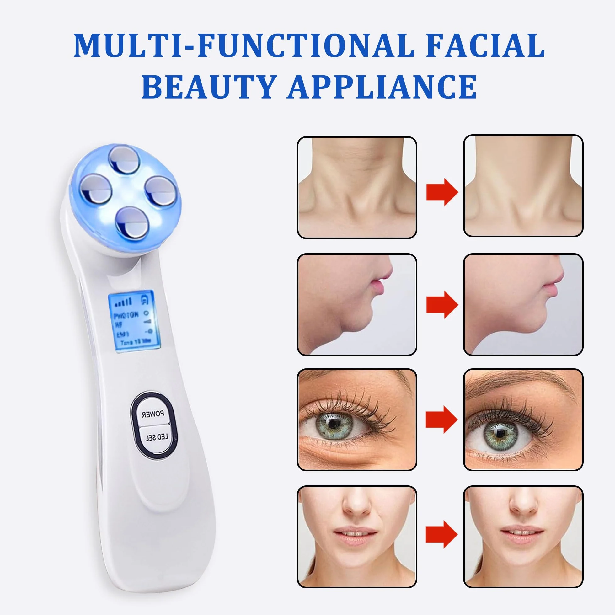 Facial Aparato Radiofrecuencia, Aparato Facial Ultrasonido, Frío Calor Roja y Azul para Antiarrugas, Limpieza Profunda, Rejuvenecimiento, Anti-envejecimiento, Anti-acné, Cuidado Facial