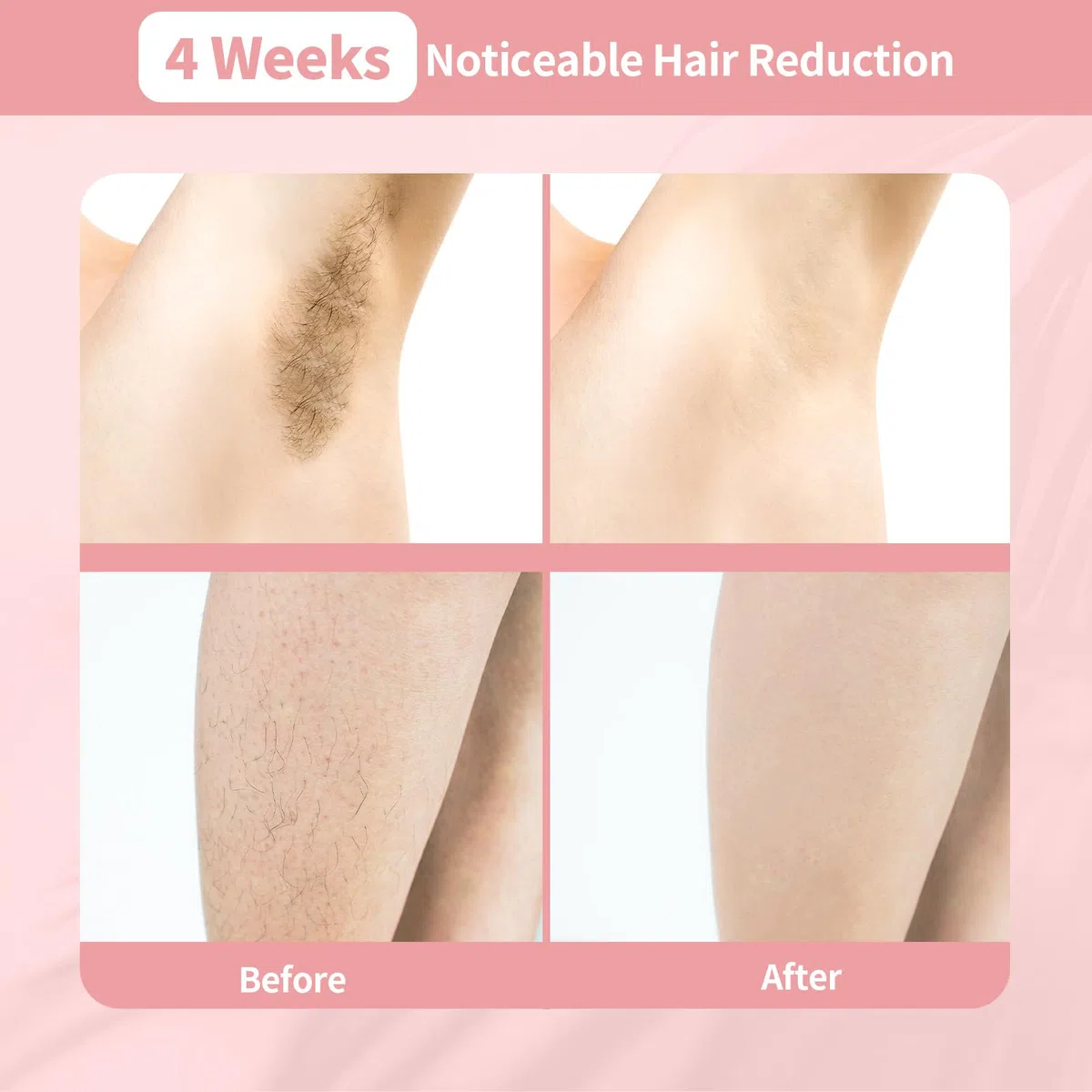 Depilación Láser para Mujeres y Hombres, Depiladora IPL 3 en 1 para Todo el Cuerpo, Indolora, Segura, Ppta para Salones de Belleza, Spas y Uso Doméstico