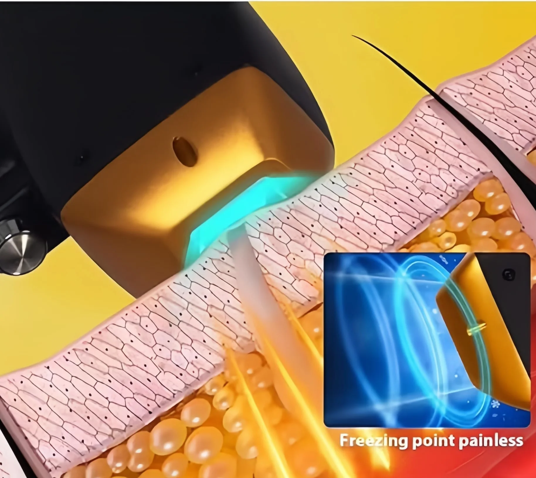 Máquina profesional de depilación láser de diodos de 4000w 4 longitud de onda 755 nm 808 nm 940 nm 1064 nm certificación CE de depilación de bikini de salón inteligente