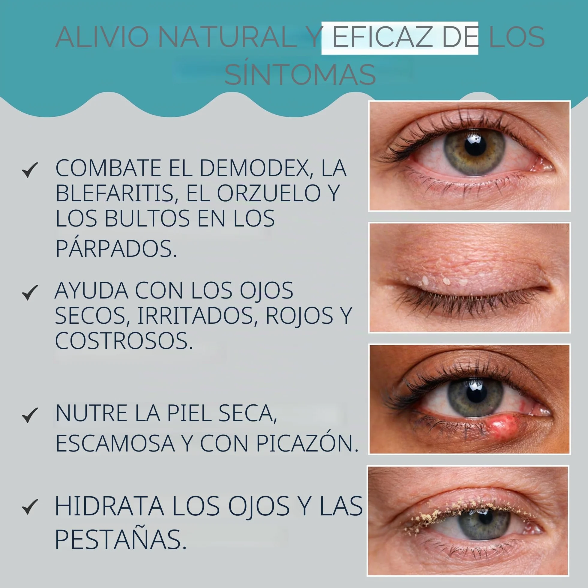 NOVEHA Demodex - Limpiador espumoso extra fuerte, con extracto de aceite de árbol de té, 100 ml