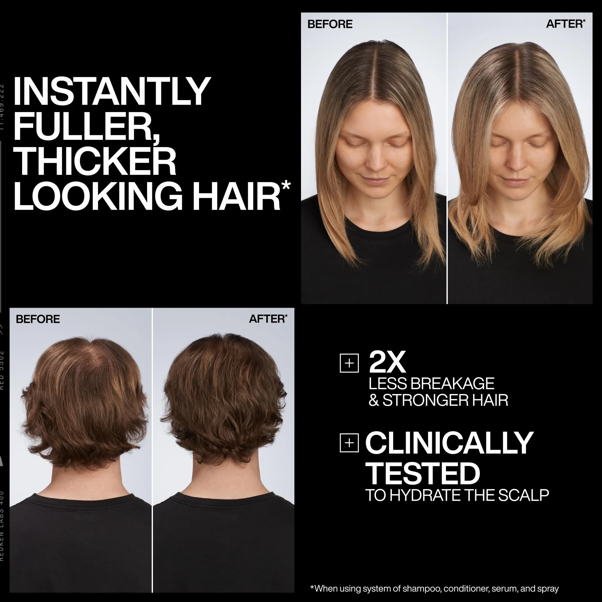 Redken, Sérum Sin Aclarado para Cuero Cabelludo Seco, Reequilibra e Hidrata, Fortalece y Densifica el Cabello, Con Ácido Azelaico y Cafeína, Acidic Grow Full System, 100 ml