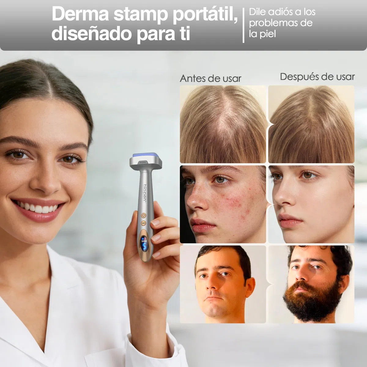 Biopen Derma Stamp 140 Pins, Microneedling + Vibración + Luz LED con 2 Cabezales Reemplazables (0,5 mm) para Cabello Debilitado/Crecimiento de la Barba/Cuidado Facial (Oro Blanco)