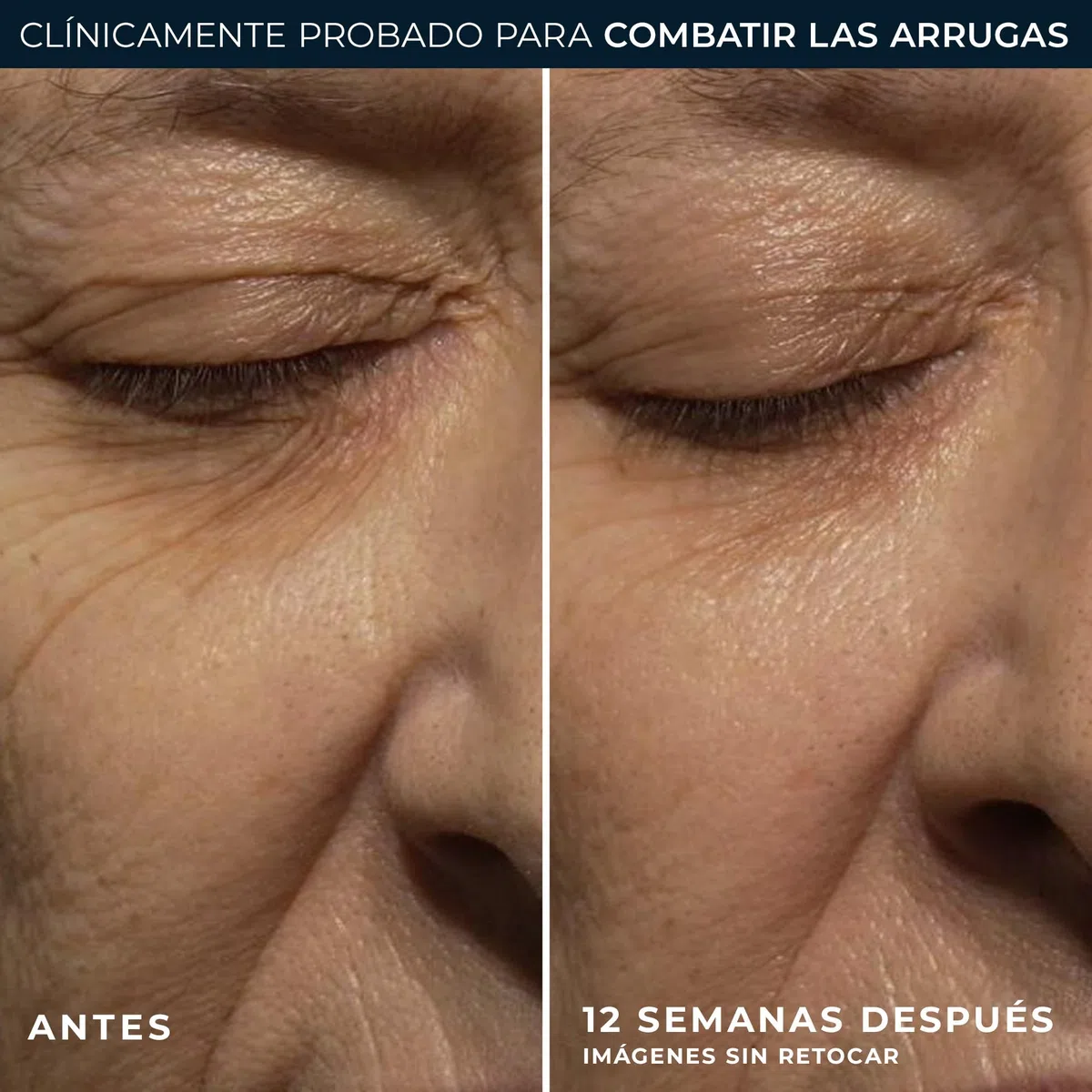 RoC Corrección de Retinol Wrinkle Corrext Crema de Noche, 30 ml